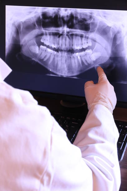 Best Emergency Root Canal Therapy in New Middletown, OH