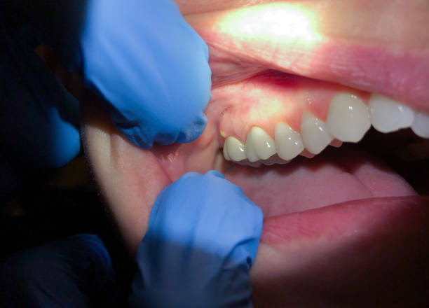 Best Emergency Pediatric Dental Care in New Middletown, OH