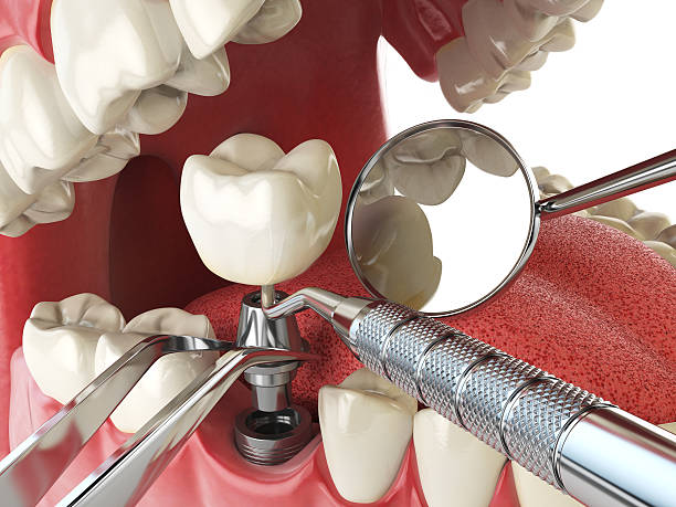 Best Emergency Dental Care for Sports Injuries in New Middletown, OH